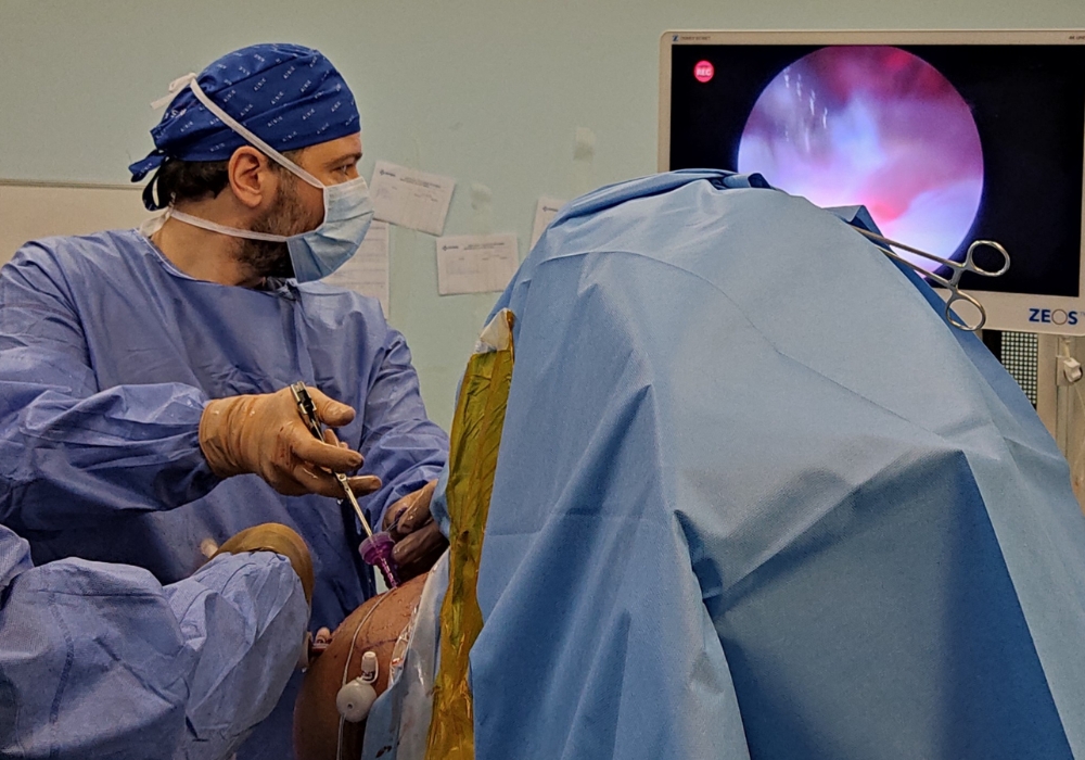 arthorskopisi omoy 2