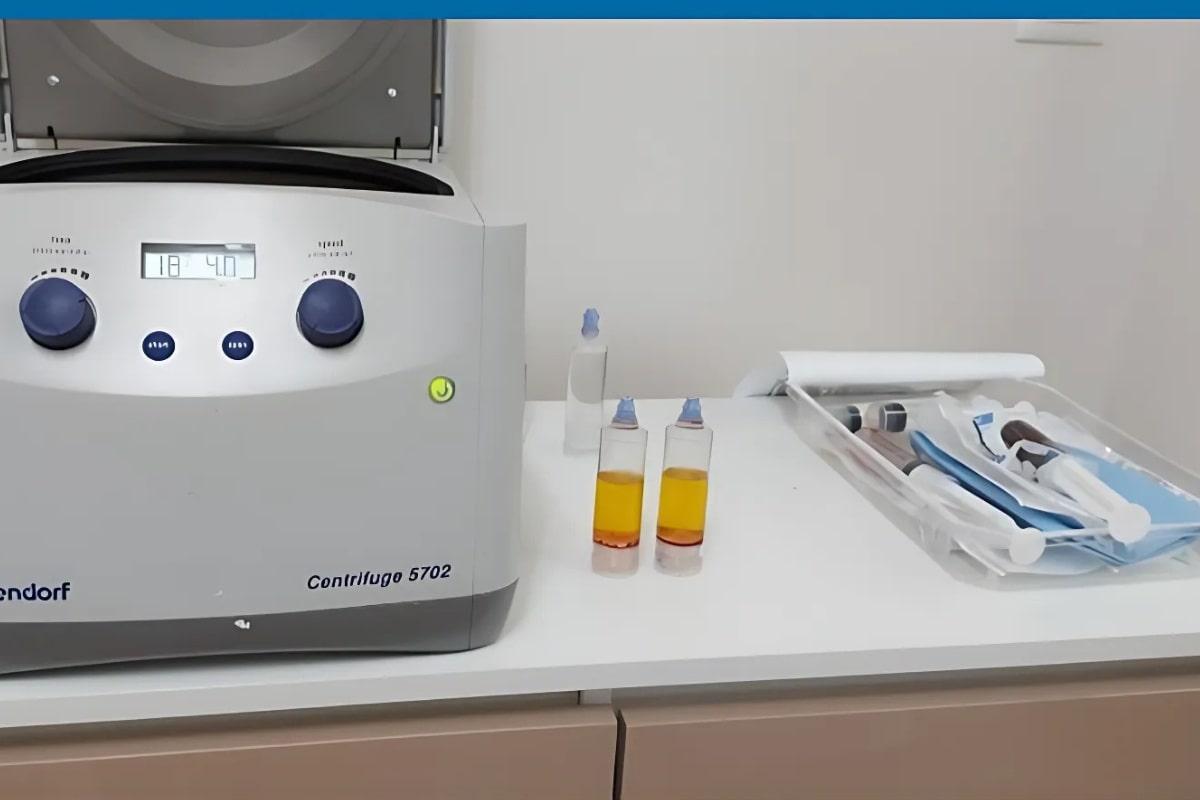 yperakanthios slider 2 min