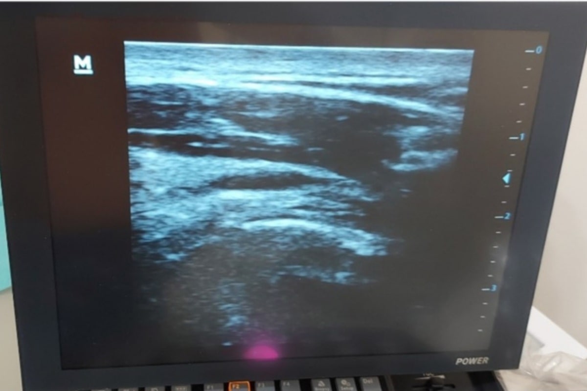 yperakanthios slider 3 min