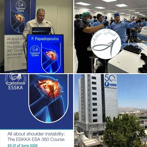 All about Shoulder Instability.The ESSKA ESA 360⁰ Course